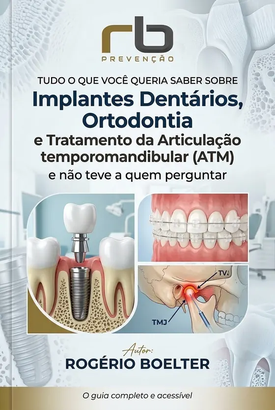 Capa do livro do Dr. Rogério Boelter sobre implantes dentários, ortodontia e tratamento da ATM